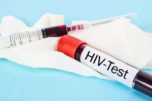 آخرین وضعیت HIV در ایران / نیمی از مبتلایان در سنین ۲۵ تا ۳۹ سال