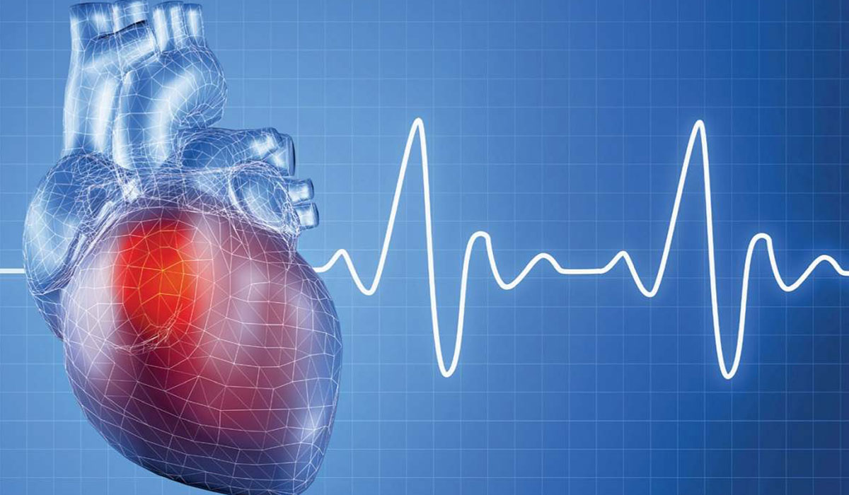 چرا زنان بیشتر از مردان در معرض خطر مرگ ناشی از حمله قلبی قرار دارند؟