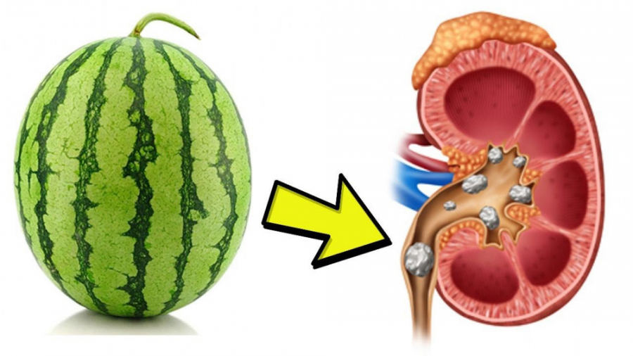 برای درمان سنگ کلیه پختن این میوه معجزه می کند+ راهنما