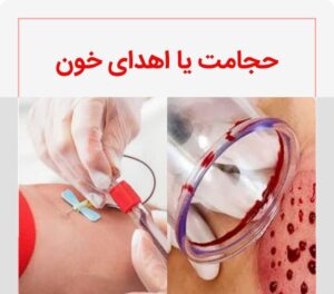 اهدای خون یا حجامت؛ کدامیک بهتر است؟