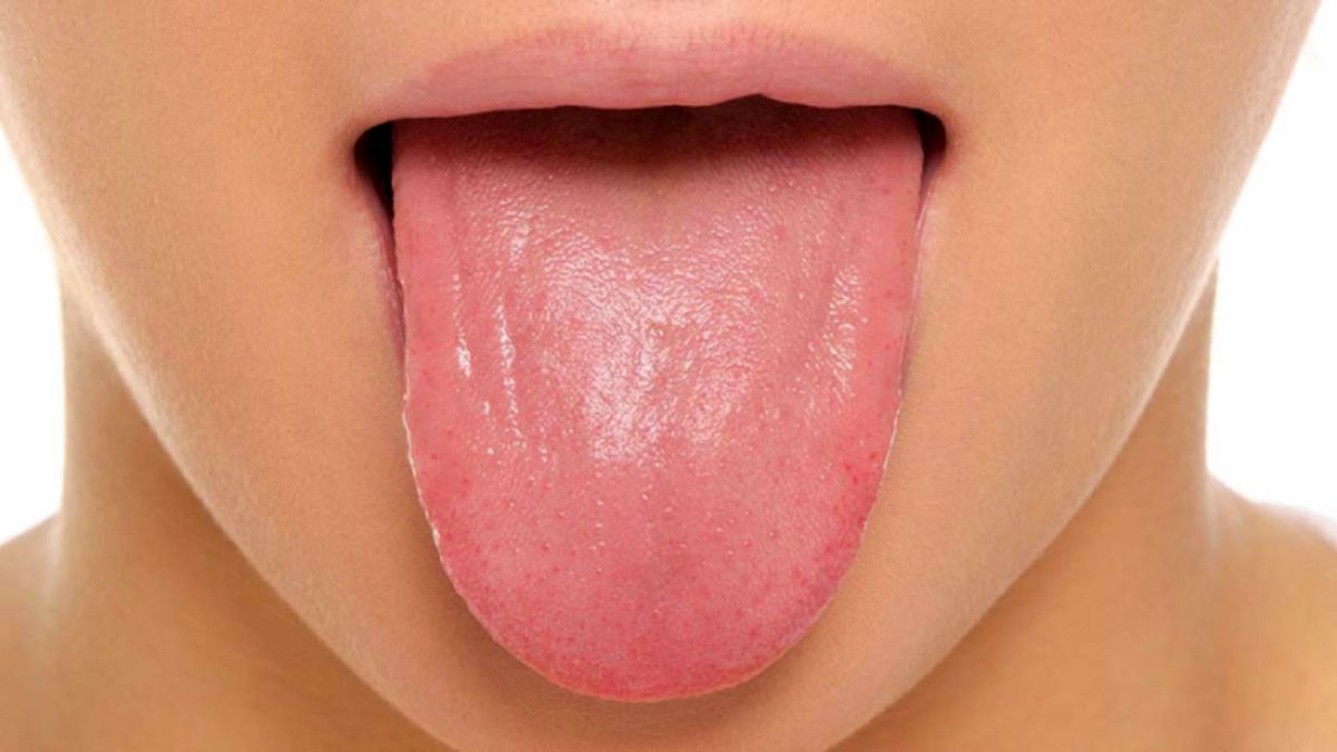 چگونه از رنگ زبان خود بیماری مان را تشخیص دهیم؟