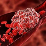 هرآنچه باید درباره غلظت خون بدانید