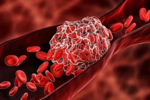 هرآنچه باید درباره غلظت خون بدانید